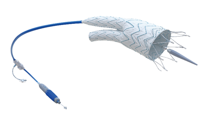 Minos?腹主動脈覆膜支架及輸送系統-2