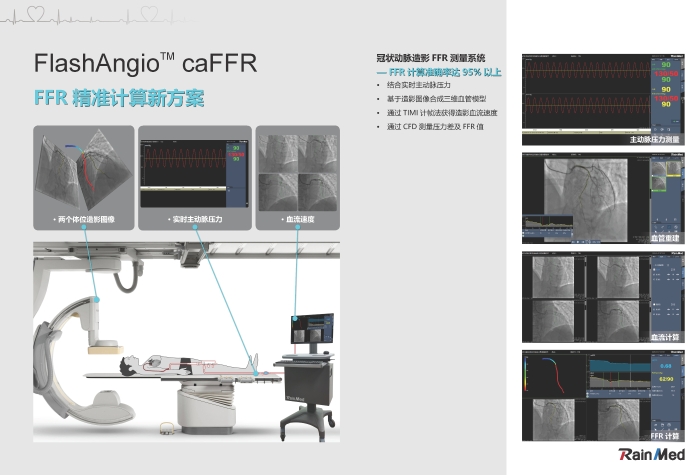 冠狀動脈造影血流儲備分數測量系統圖片3