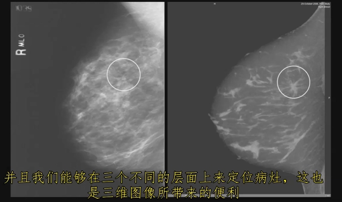 KBCT產品優(yōu)勢3