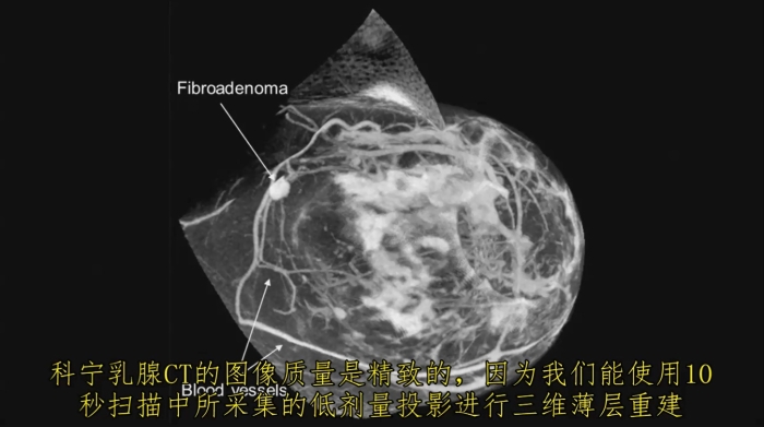 KBCT產品優(yōu)勢4-1