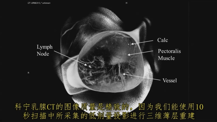 KBCT產品優(yōu)勢4-2
