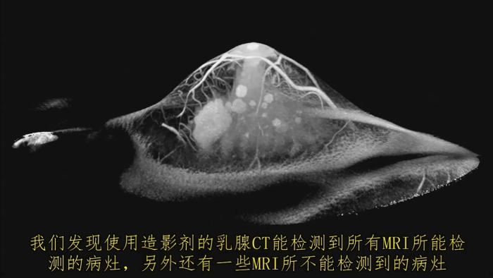 KBCT產品優(yōu)勢7