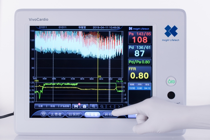 血流儲備分數測量設備圖片